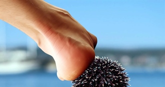 NEZGODA NA PLAŽI: Stali na ježinca? Što nikako ne smijete napraviti!